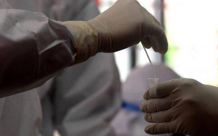 സംസ്ഥാനത്ത് ഇന്ന് 7515 പേര്‍ക്ക് കോവിഡ്; ടെസ്റ്റ് പോസിറ്റിവിറ്റി നിരക്ക് 10.23